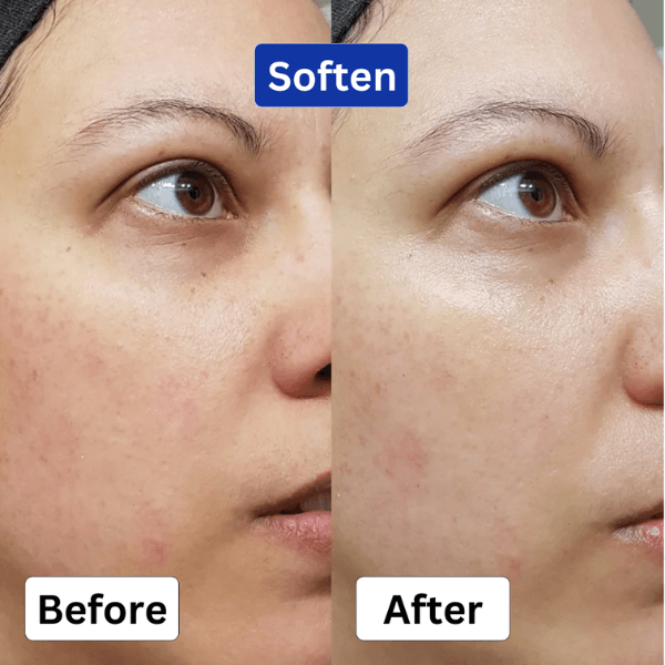 Brightens_Skin_600_x_600_px_1_88b35529